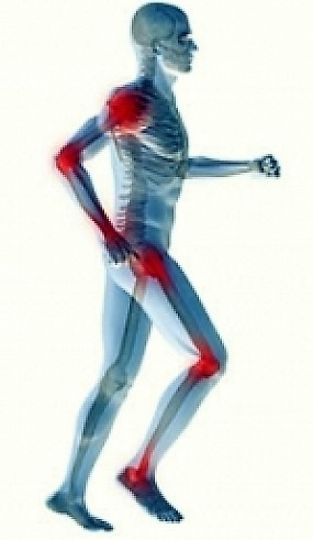 Arthritis Pain Relief